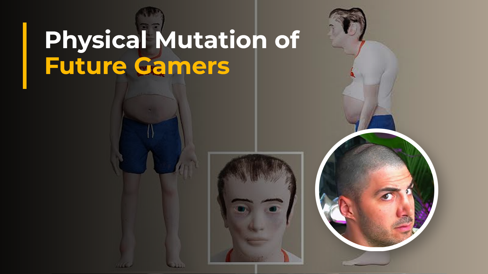 The Future of Gamers: Debunking Headphone Dents and Unveiling the Dangers of an Unhealthy Lifestyle